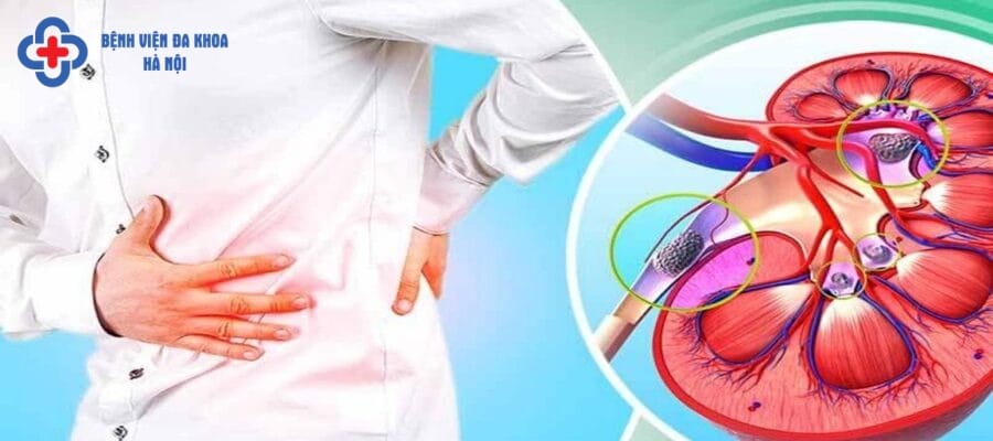 Cơn đau sỏi thận xuất phát từ nhiều nguyên nhân