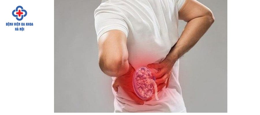 Sỏi bàng quang dễ gây nên nhiều biến chứng