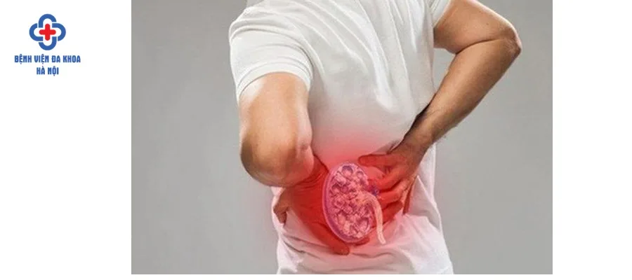 Sỏi bàng quang dễ gây nên nhiều biến chứng