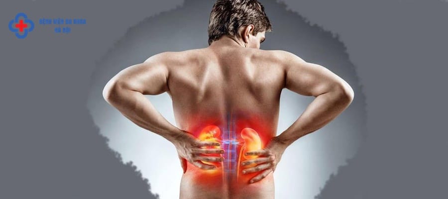 Đau sỏi thận thường quặn thắt