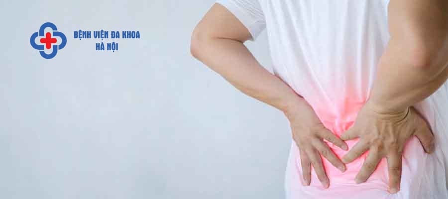 Sỏi thận cũng gây đau lưng, mệt mỏi cho người bệnh