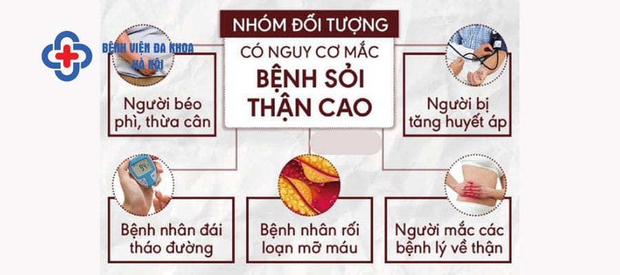 Một số nhóm đối tượng dễ mắc sỏi thận