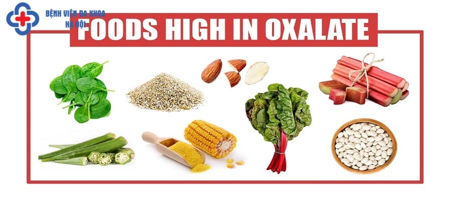 Hạn chế sử dụng đồ ăn có hàm lượng Oxalat và canxi lớn