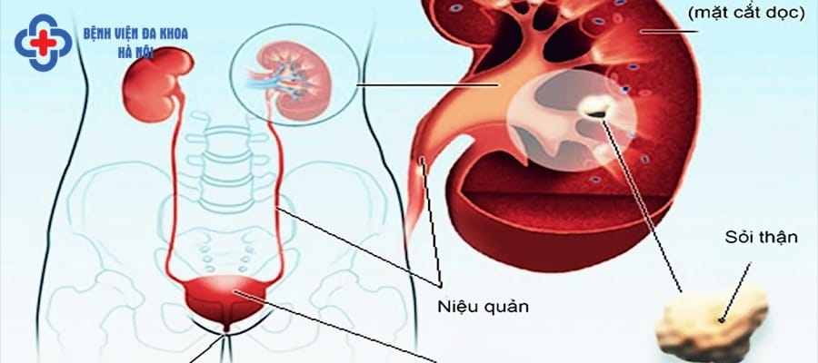 Hệ tiết niệu thường xuất hiện những căn bệnh nguy hiểm