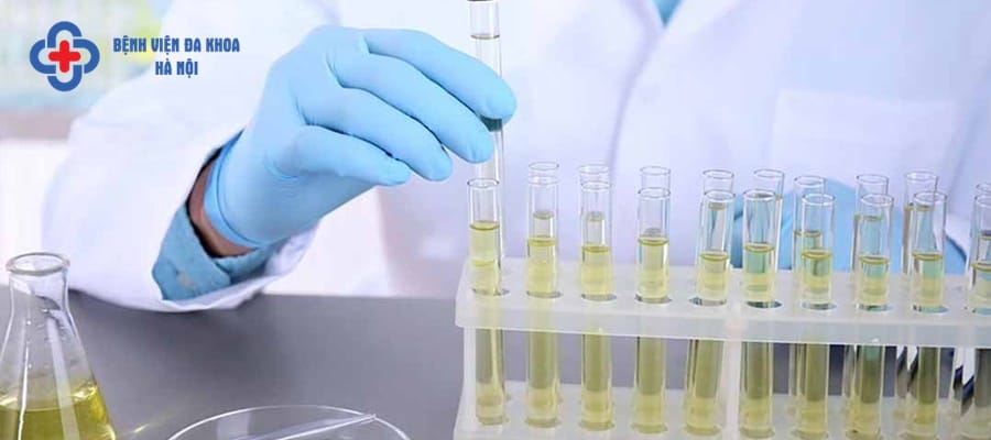 Kiểm tra nước tiểu xác định hoạt động của thận