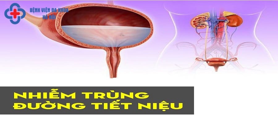 Nhiễm khuẩn đường tiết niệu xảy ra chủ yếu ở nữ giới