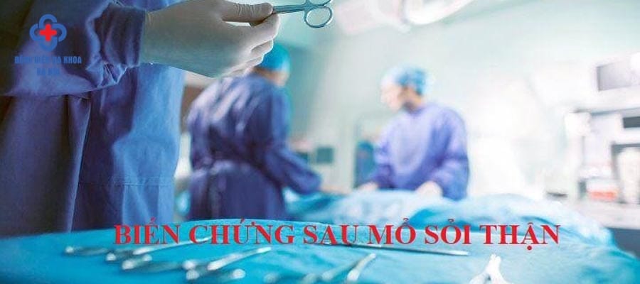 Sỏi thận nên điều trị bằng phương pháp an toàn bien chung mo soi than