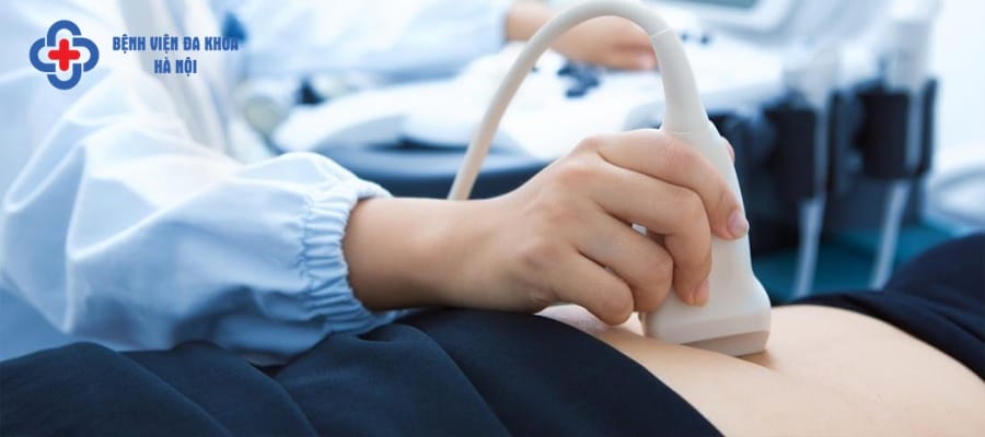 Siêu âm sỏi thận giúp xác định chính xác vị trí sỏi