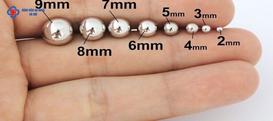 Sỏi thận 7mm là trường hợp bệnh đã chuyển biến nặng