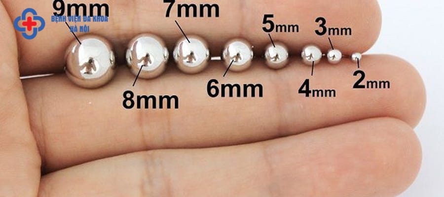 Sỏi thận 9mm có kích thước trung bình