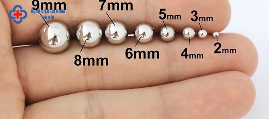Sỏi thận 9mm có kích thước trung bình 