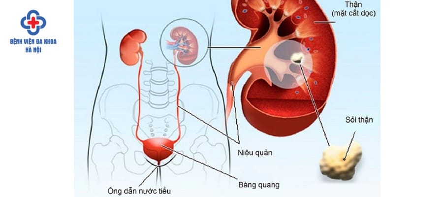 Điều trị bệnh sớm để tránh biến chứng nguy hiểm
