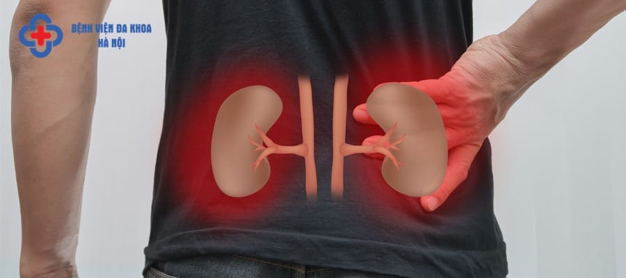 Sỏi thận hình thành gây ảnh hưởng lớn tới sức khỏe người bệnh