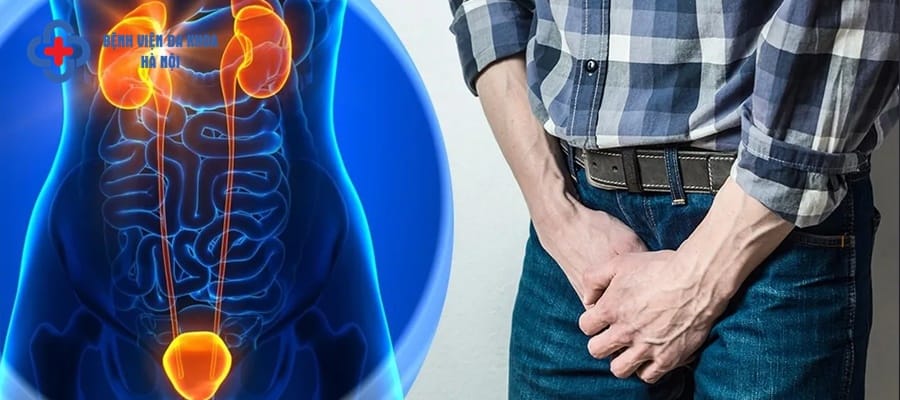 Sỏi thận khiến người bệnh tiểu rắt thường xuyên