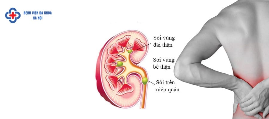 Cần thăm khám sớm để phát hiện, điều trị bệnh