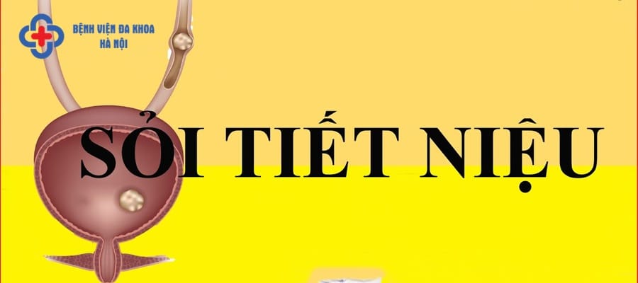 Sỏi tiết niệu phân thành từng loại khác nhau