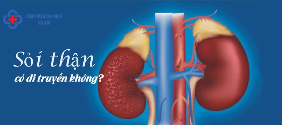 Các vị trí sỏi đường tiết niệu thường gặp