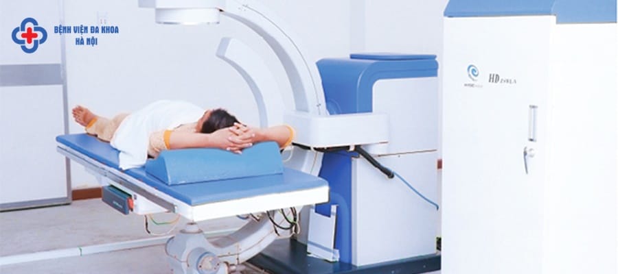 Tán sỏi ngoài cơ thể vẫn có nhiều nhược điểm