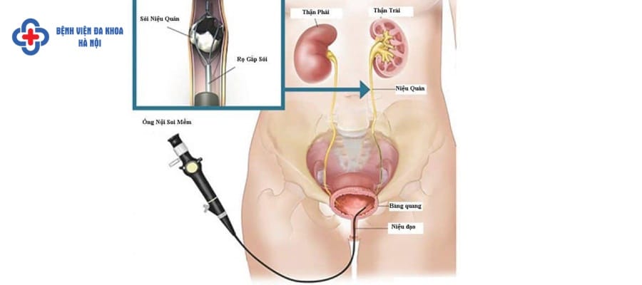 Điều trị ít xâm lấn đang được ưu tiên sử dụng