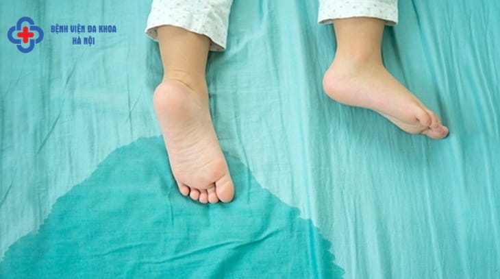 Có nhiều nguyên nhân gây tiểu không tự chủ