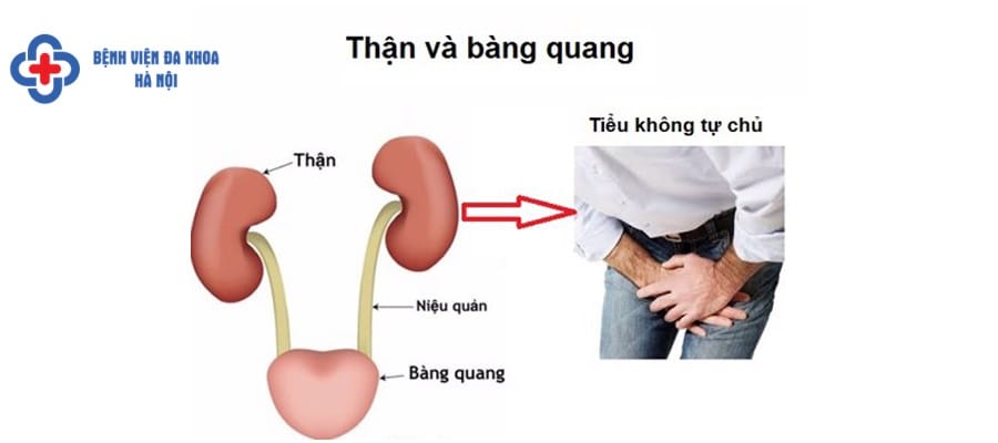 Tiểu không tự chủ gây phiền toái cho người bệnh