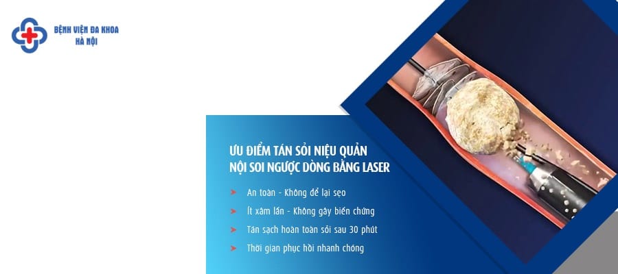 Tán sỏi ngược dòng, chữa sỏi thận an toàn, hiệu quả