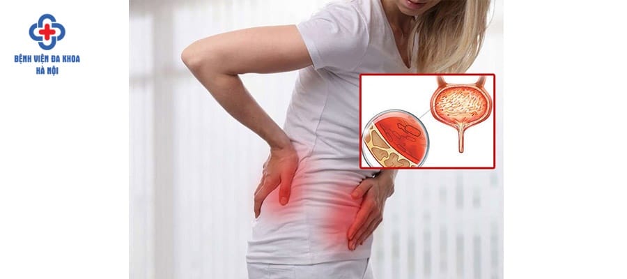 Đau lưng quặn thắt, dữ dội cũng do viêm bàng quang gây ra