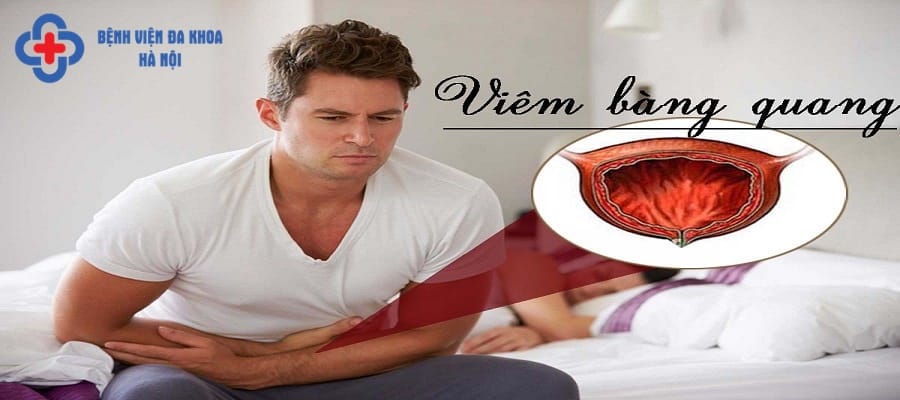 Viêm bàng quang ở mức độ nhẹ sẽ dễ điều trị hơn