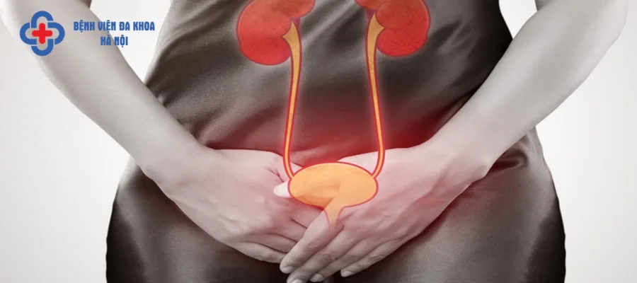 Viêm đường niệu là biến chứng thường gặp hậu mổ sỏi