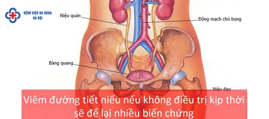 Nên khám viêm đường tiết niệu ở địa chỉ uy tín viem duong tiet nieu kham o khoa nao