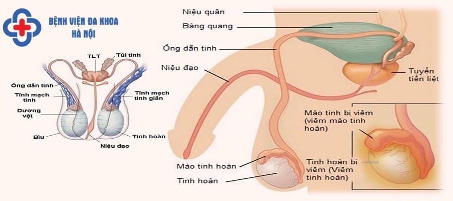 Viêm đường tiết niệu nếu không điều trị sớm có thể gây ra các biến chứng nguy hiểm