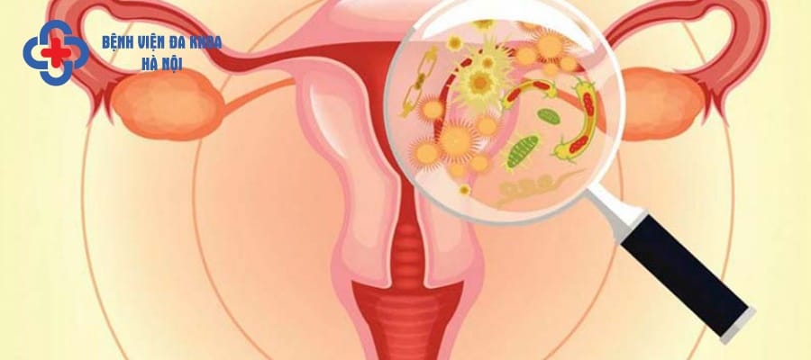 Biến chứng nhiễm khuẩn tiết niệu nguy hiểm