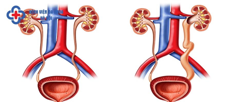 Cấu tạo hệ tiết niệu trong cơ thể người