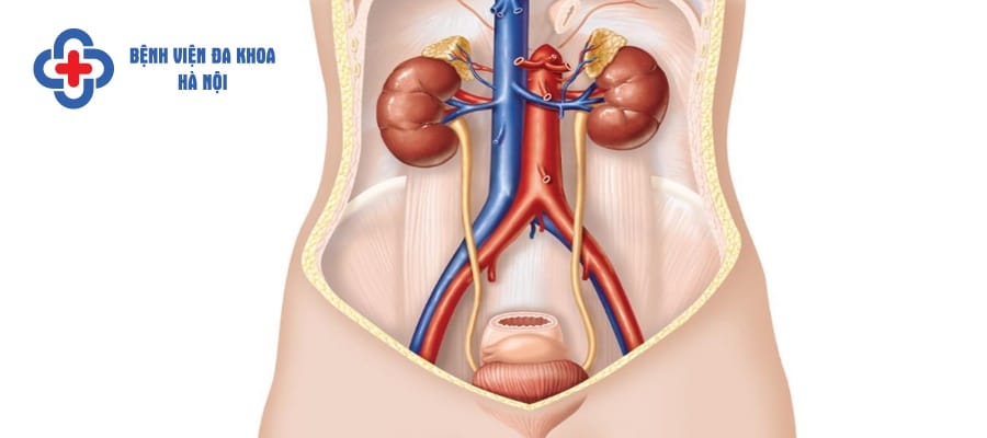 Đường niệu thông suốt sẽ hạn chế đau trong khi tán sỏi