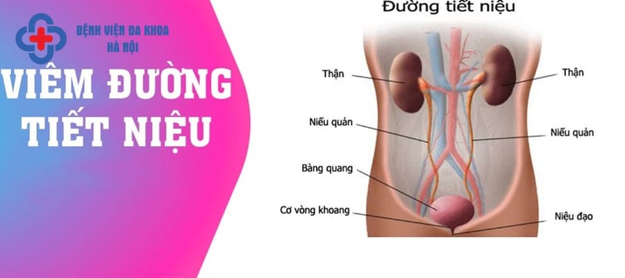 Viêm đường tiết niệu là biến chứng thường gặp ở người mắc sỏi niệu quản