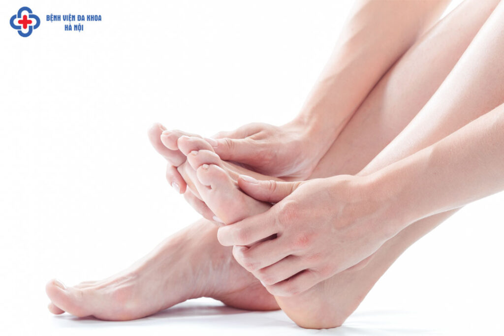 bệnh gout