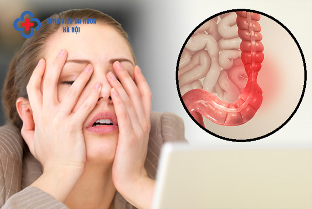 hội chứng ruột kích thích