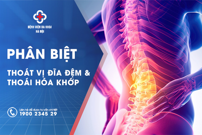 thoát vị đĩa đệm