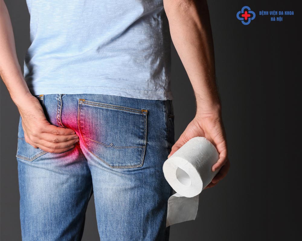 Nứt kẽ hậu môn