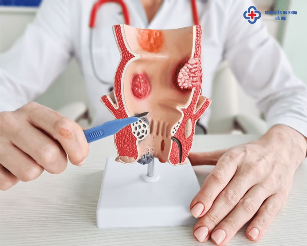 Đi vệ sinh ra máu là dấu hiệu của bệnh gì