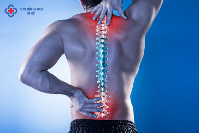 Bị thoái hóa đốt sống lưng có nên đi bộ không?