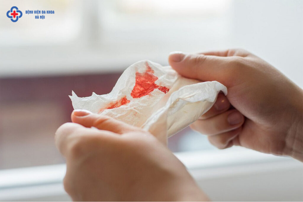Máu trong đờm có nguy hiểm gì đến tính mạng không?