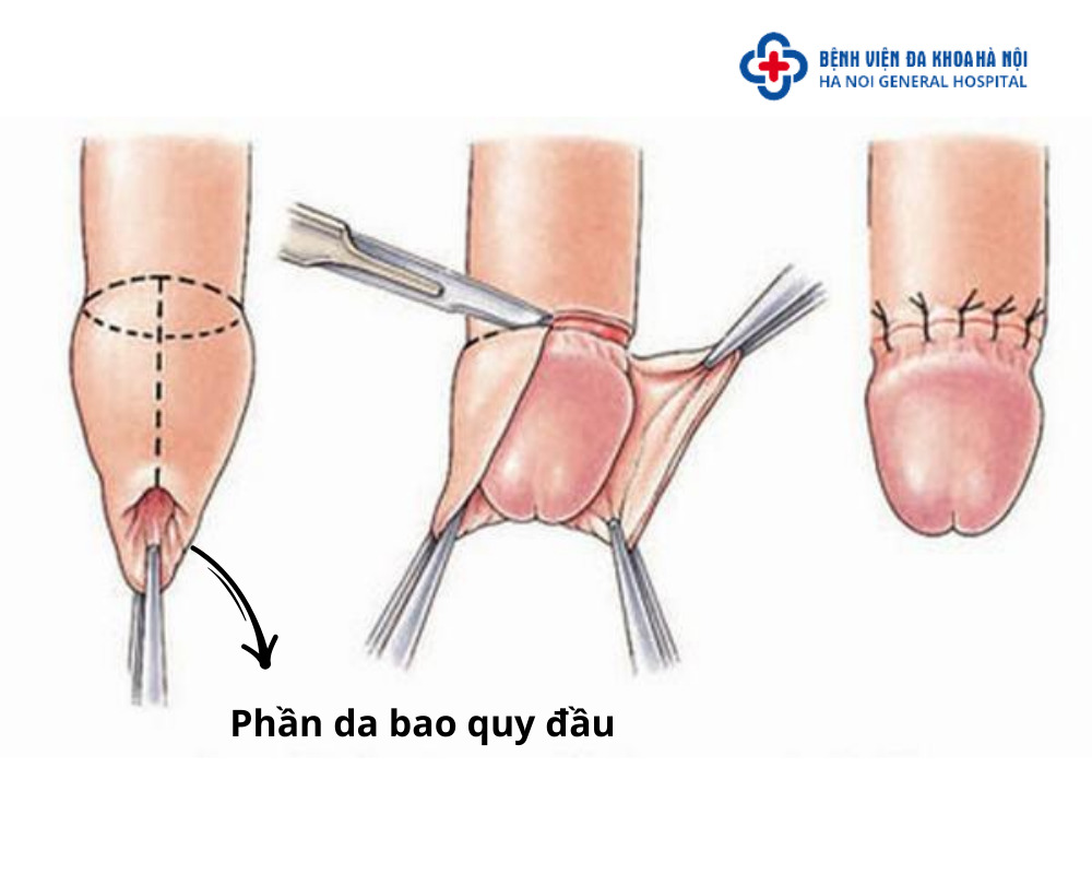 Bao quy đầu có chức năng gì
