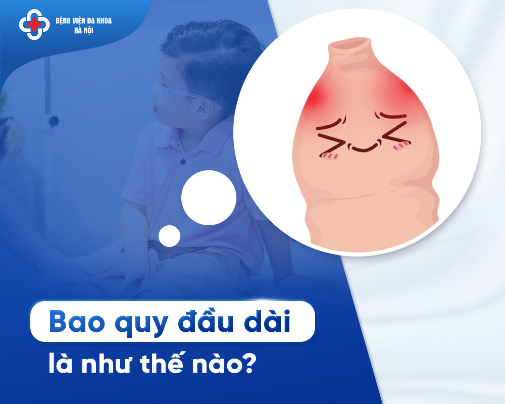 Bao quy đầu dài
