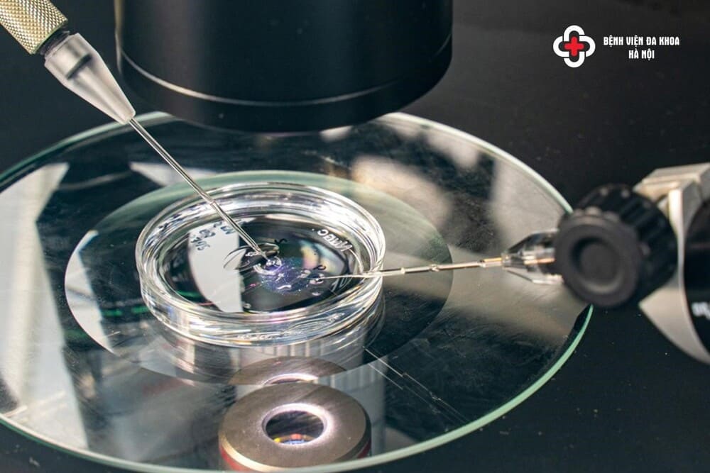 ICSI phải được thực hiện trong môi trường phòng lab hiện đại, vô trùng, khép kín