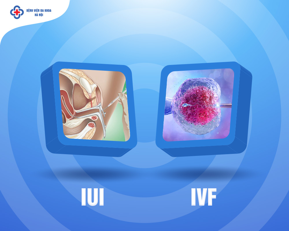 IUI có chi phí thấp hơn IVF tuy nhiên hiệu quả cũng thấp hơn