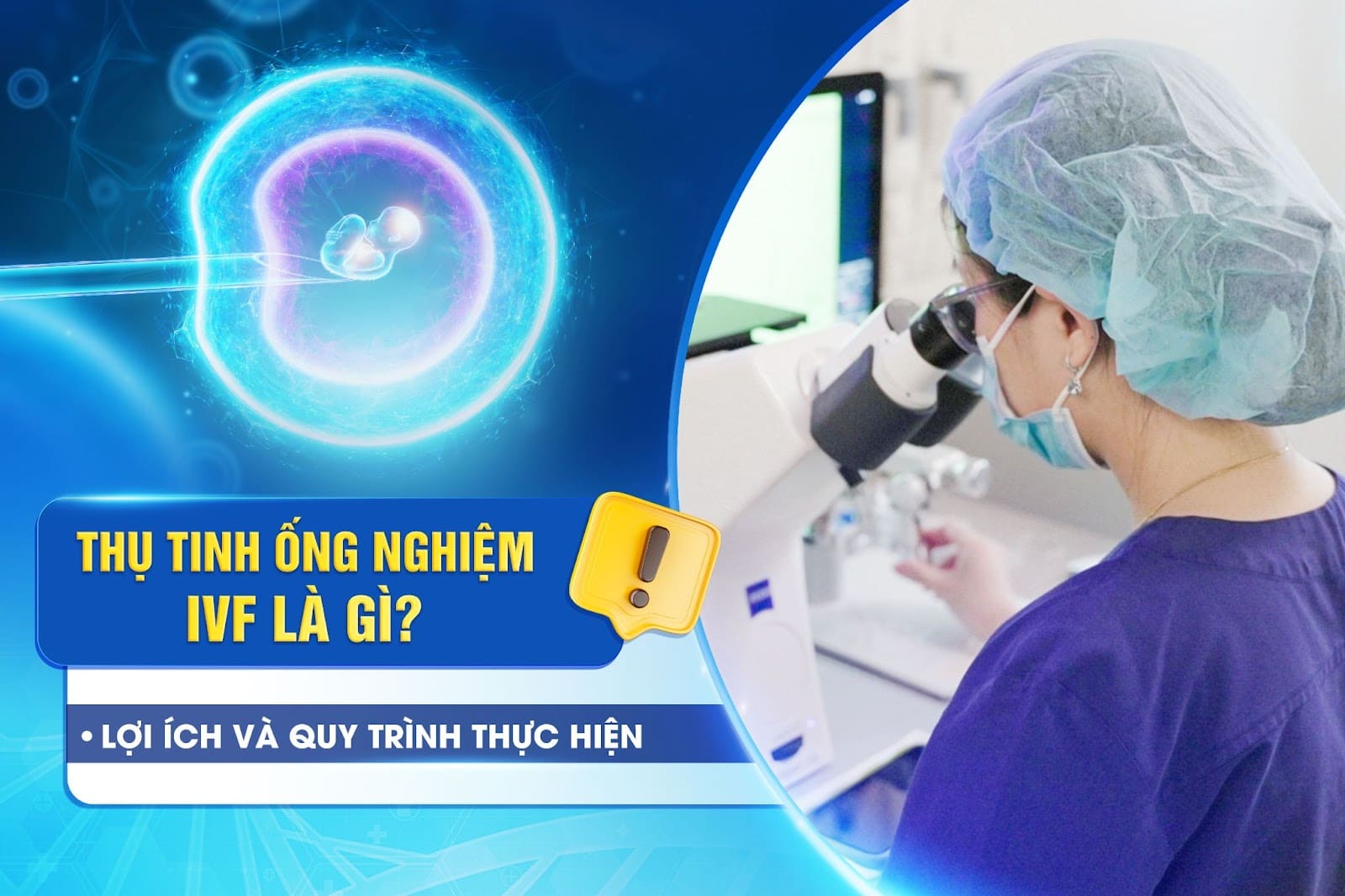 IVF là gì