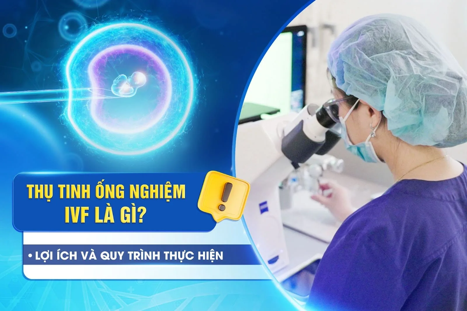 IVF là gì