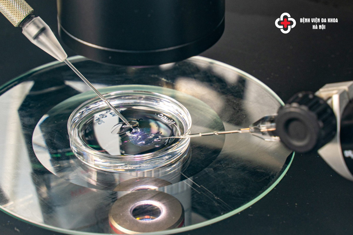 ưu nhược điểm của ivf