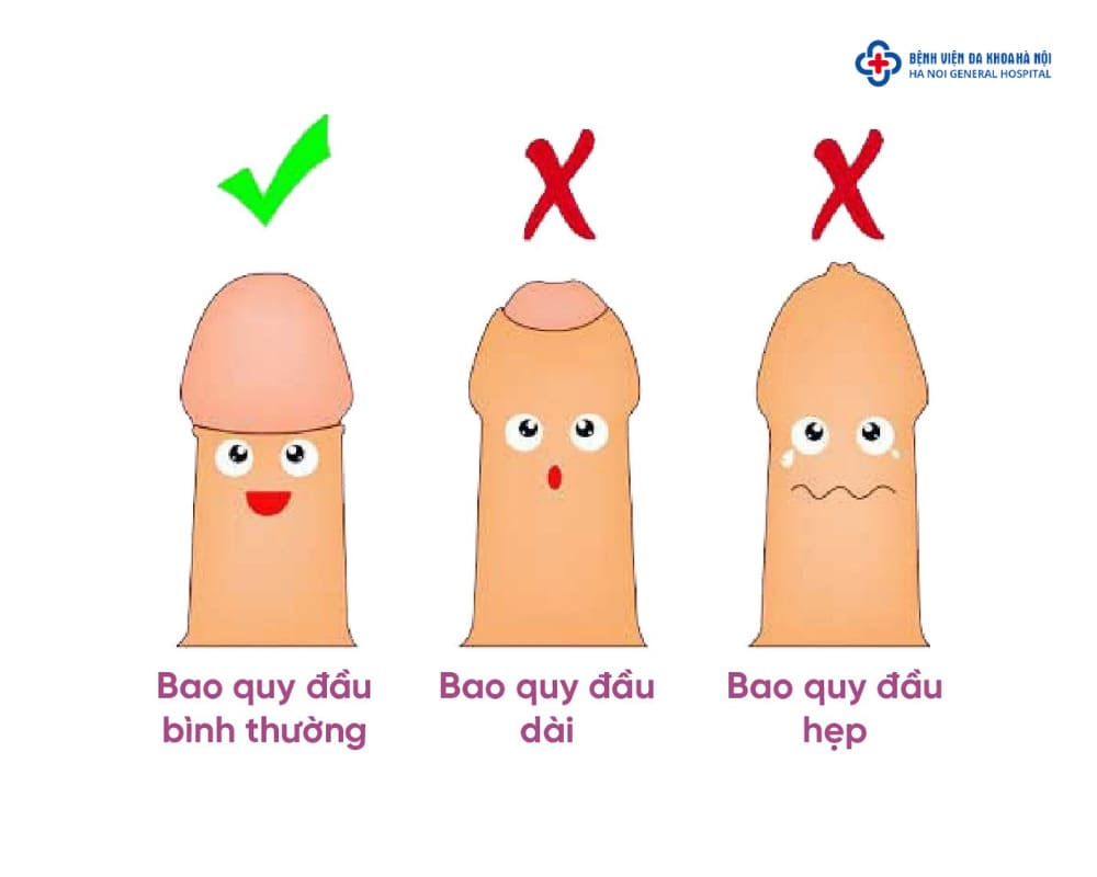 Khi nào nên lột bao quy đầu